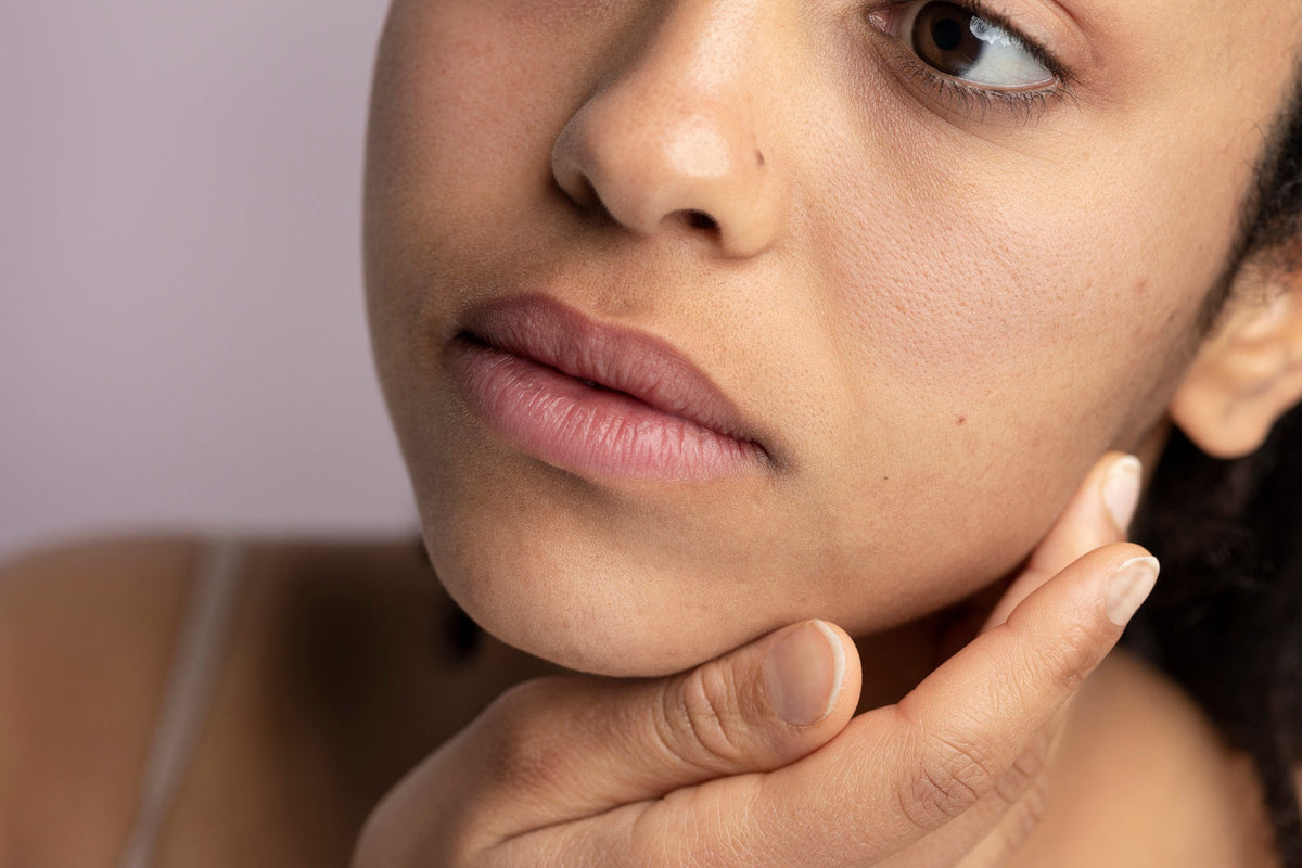 How to Treat and Repair Damaged Skin Naturally